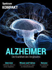 Cover Spektrum Kompakt: Alzheimer – Die Krankheit des Vergessens
