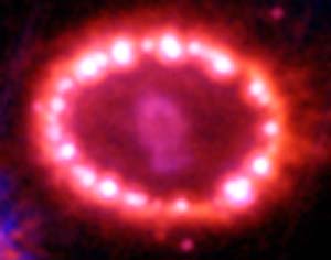 SN 1987A beobachtet mit HST