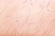 <em>Fusobacterium nucleatum</em> in Kulturmedium <em>Fusobacterium nucleatum</em> in Kulturmedium