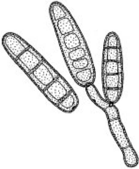 Helminthosporium spórák. Kukorica északi levélfoltossága (Helminthosporium turcicum)