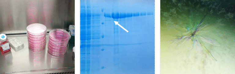 Proteinverklumpungen entwirren: Auf dem Pfad zur Heilung von Chorea Huntington