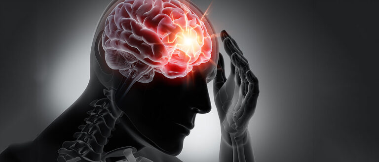 Schlaganfall und Stammzellen