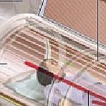 Magnetresonanztomografie